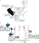 Frontiers The Reality of Myoelectric Prostheses: Understandi